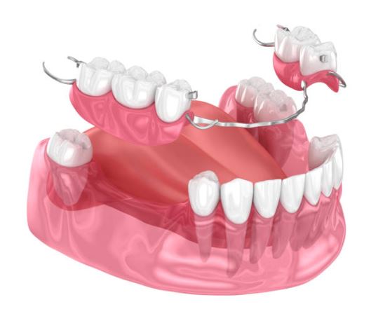partial removable dentures