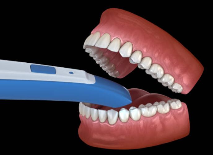 CAD/CAM dentistry