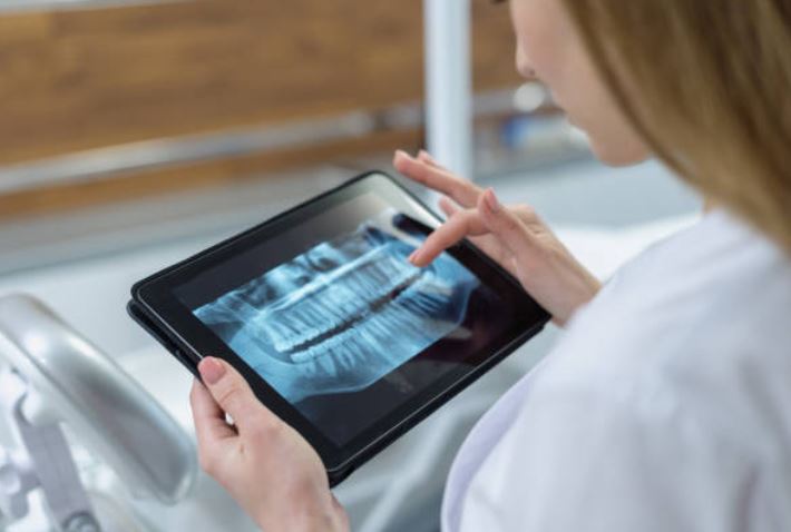 Digital X-Ray
