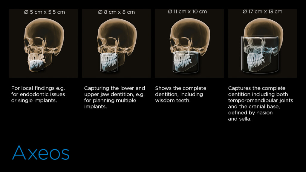 3D CT Scan